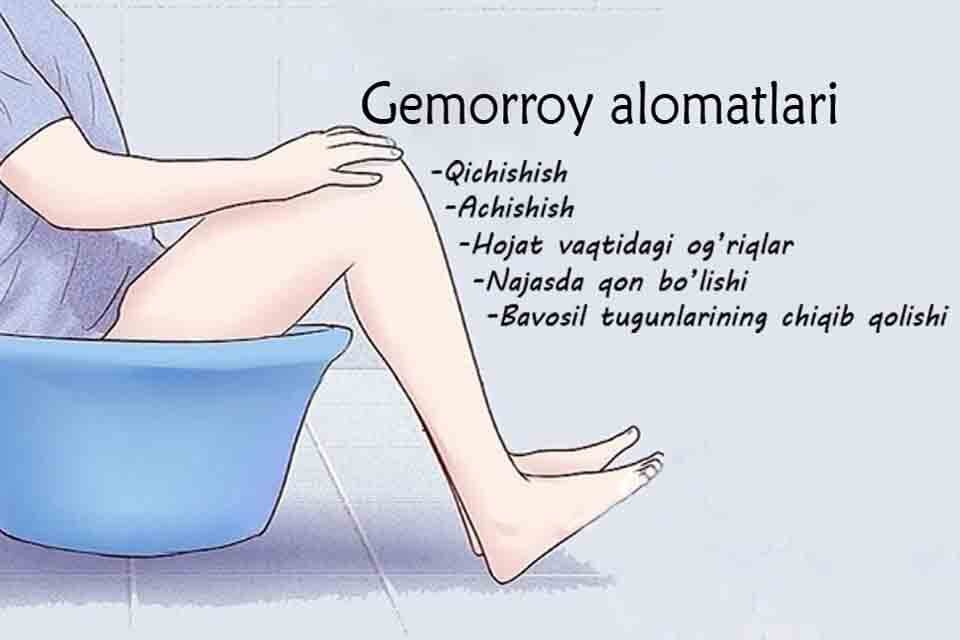 Prostatitis Alomatlari